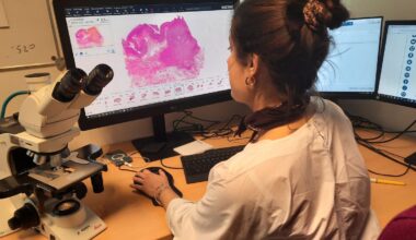 L'intelligence artificielle au service des patients au CHU de Lille