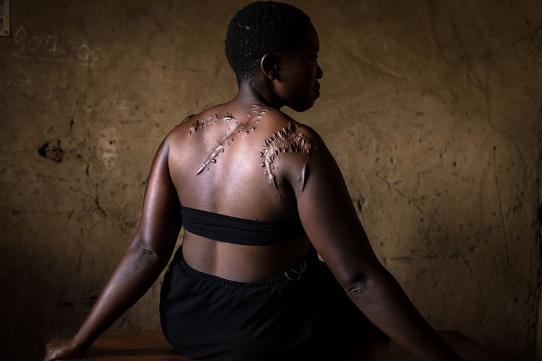 Georgette Ndovya Kavugho (32 ans) a été attaquée par des membres des ADF, un groupe islamiste ayant noué des liens avec l’État islamique. Selon une étude de la BBC, les ADF sont le groupe terroriste le plus meurtrier opérant dans l’est de la RDC. Ils seraient responsables de plus de la moitié des victimes civiles dans ce conflit.
