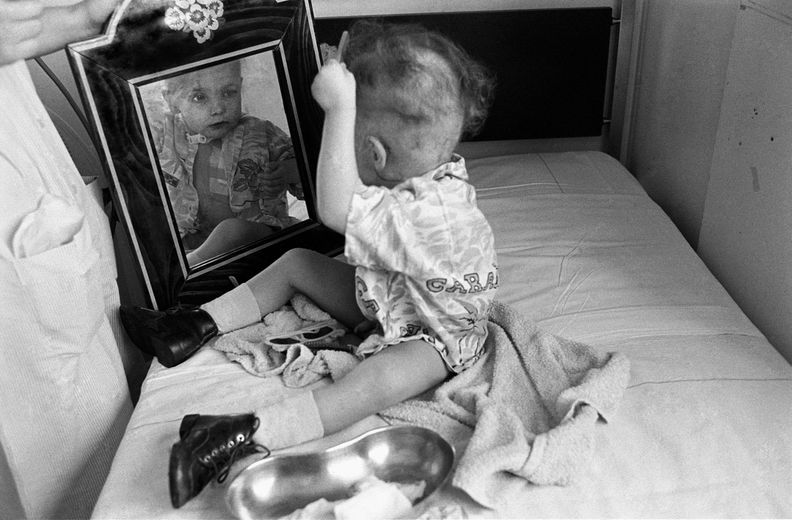Denis adore se peigner. Chaque matin, l’infirmière lui apporte son miroir. Institut Curie, Paris, 1990.