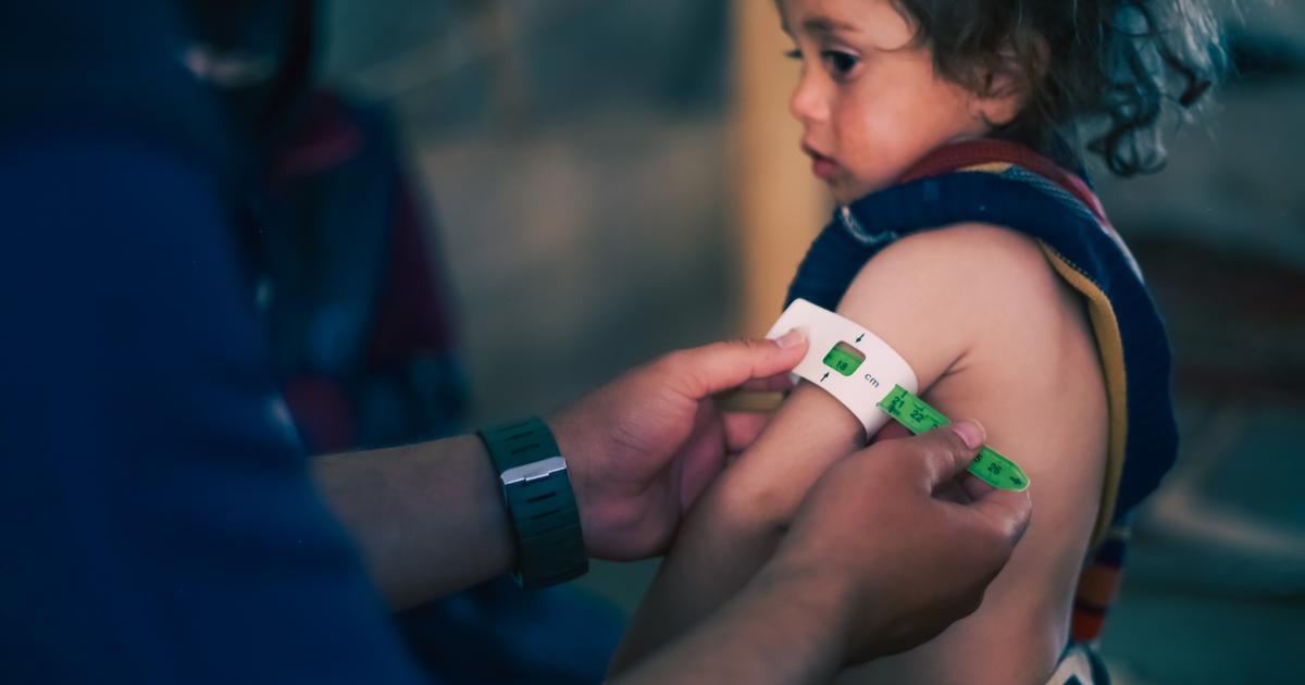 Le diabète de type 5, un « nouveau » diabète qui touche des patients trop minces