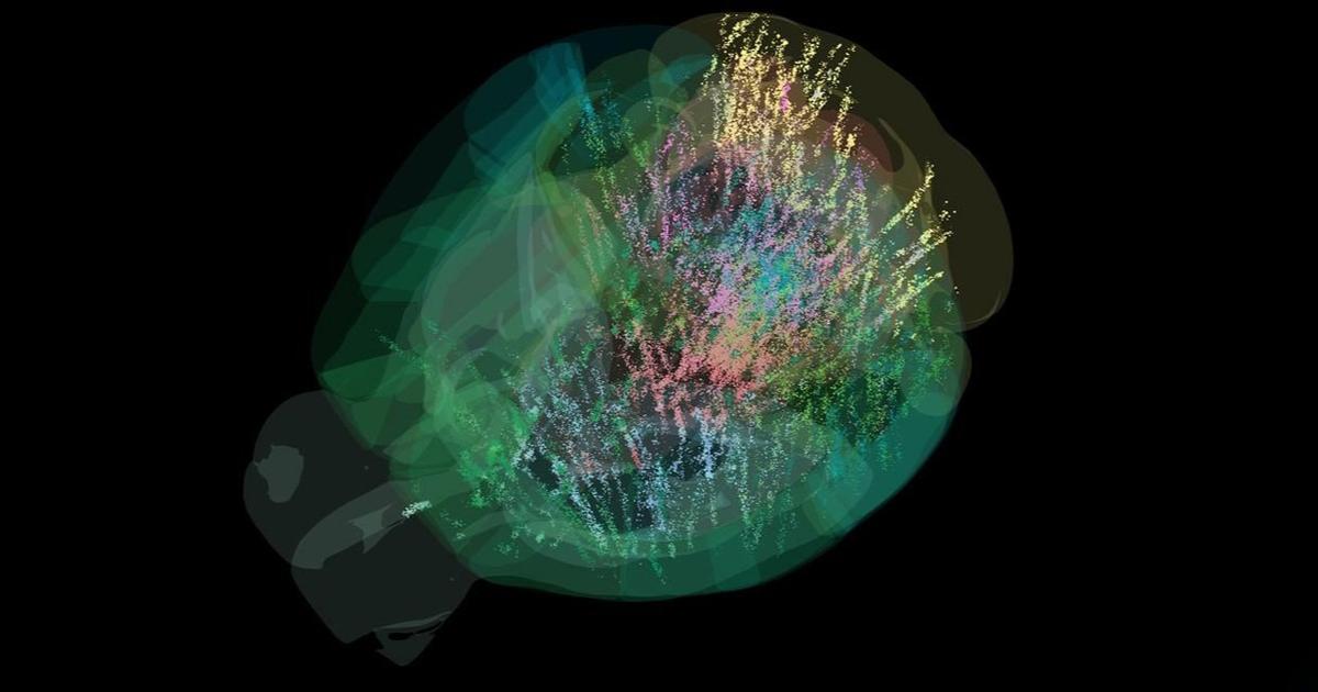 des chercheurs observent le cerveau lors d’une prise de décision