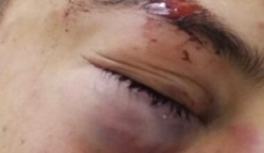 "La violence fasciste reste impunie"