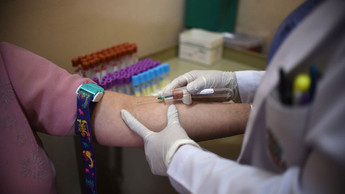 « C’est très intrigant » : les infections à hépatite A en pleine « recrudescence » en France