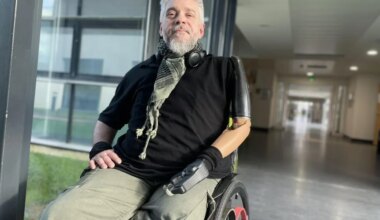 Un documentaire sur l’aventure du bras bionique et sa chirurgie pratiquée exclusivement à Nantes