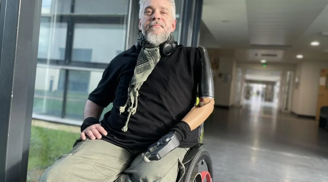Un documentaire sur l’aventure du bras bionique et sa chirurgie pratiquée exclusivement à Nantes