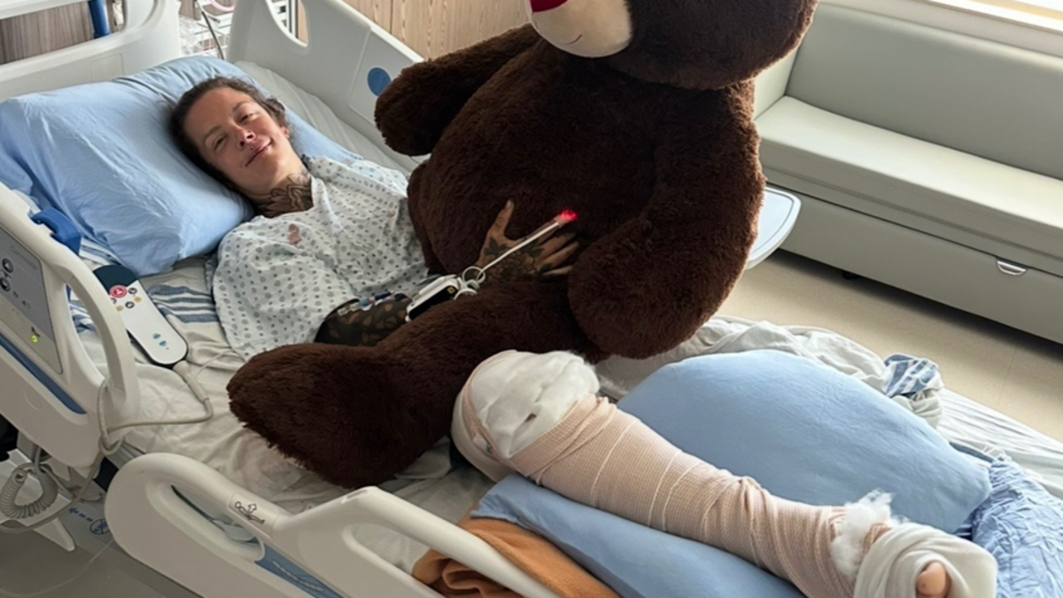 « J’ai eu l’instinct de m’agripper à son harnais » : une randonneuse chute de 18 mètres en tentant de sauver son chien qui glissait