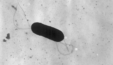 La listériose touche de plus en plus les Franciliens