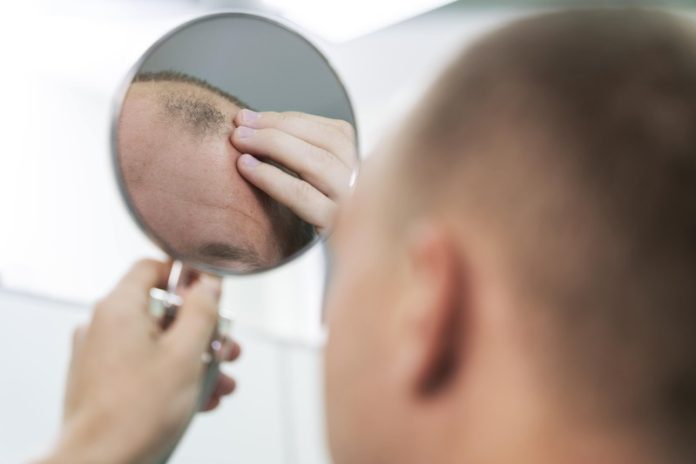 calvitie traitement à base de finastéride dépression troubles sexuels idées suicidaires Ma Santé Un jeune homme qui souffre de calvitie et qui veut prendre le traitement à base de finastéride.