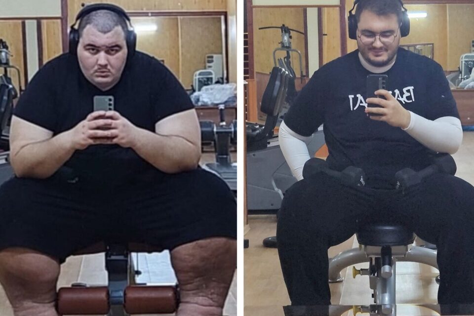 Saiyan Turk a perdu plus de 110 kilos en moins d'un an.