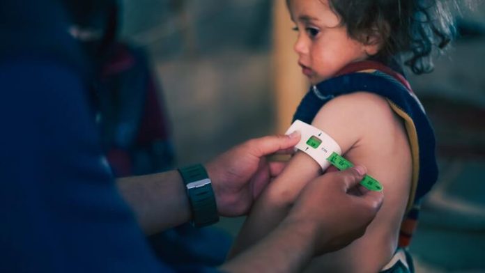 diabète de type 5 malnutrition dénutrition anorexie maladies chroniques Ma Santé Une petite fille qui passe des tests pour savoir si elle est en état de dénutrition.