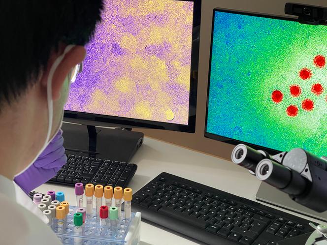 Un technicien de laboratoire effectuant des recherches à partir d’images du virus de l’hépatite A, le 5 septembre 2021.
