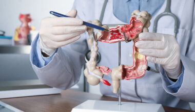 ce médicament banal permettrait de réduire significativement la récidive