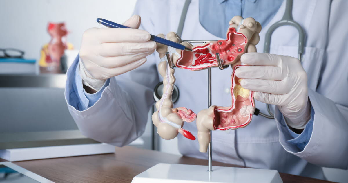 ce médicament banal permettrait de réduire significativement la récidive