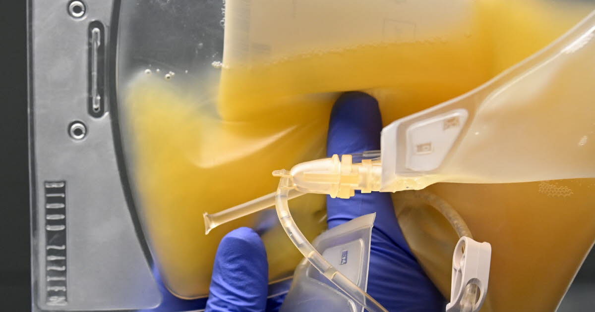 Saint-Étienne. Pourquoi faut-il collecter plus de plasma en France ?