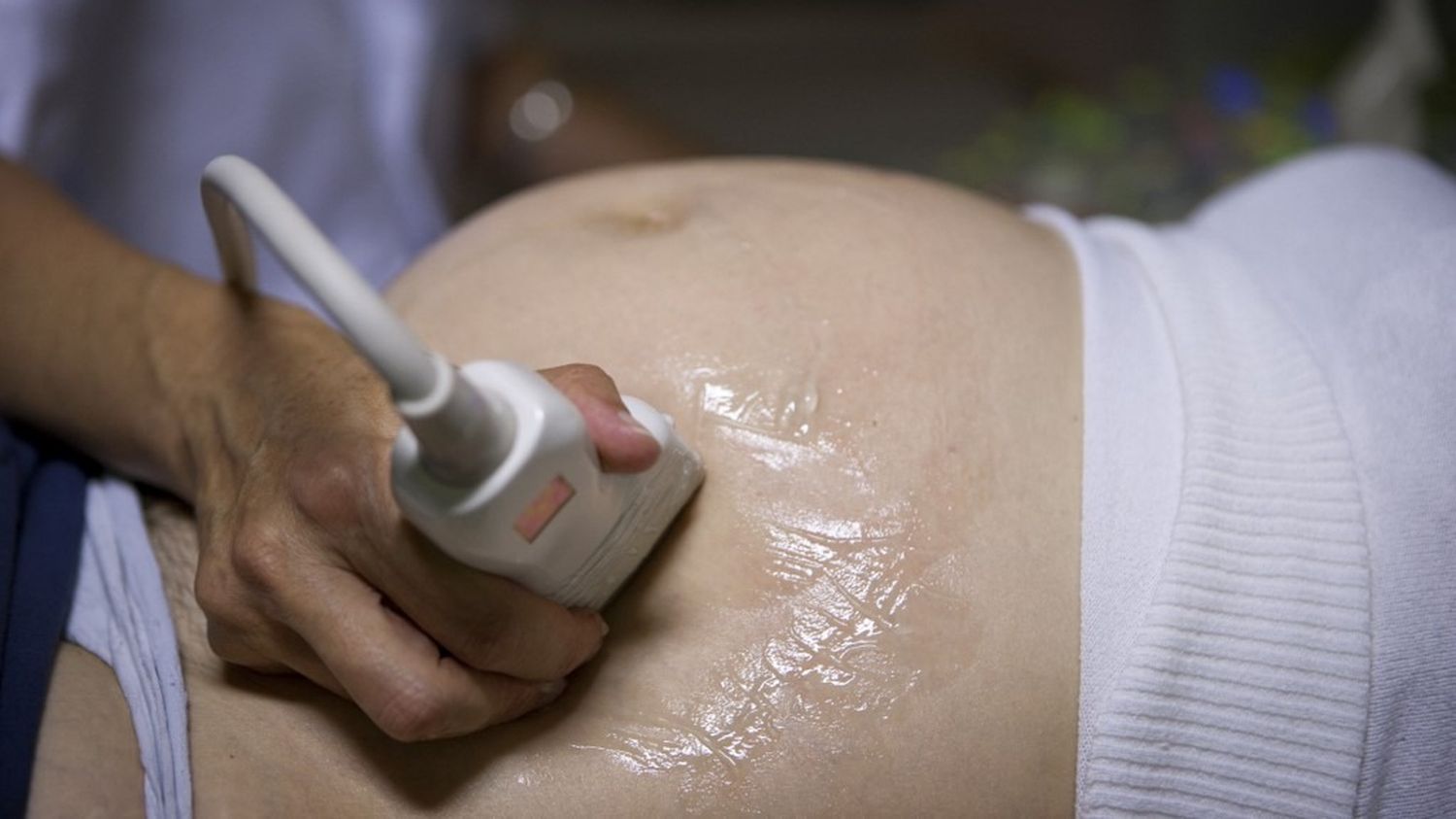 Une médecin qui n'a pas décelé la trisomie 21 pendant la grossesse a été condamnée à payer 300 000 euros d'indemnités aux parents