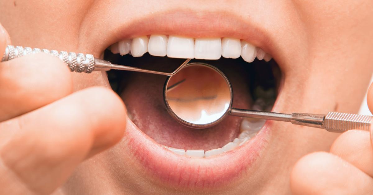 Vous avez des caries et des problèmes de gencives ? Attention au risque d’AVC