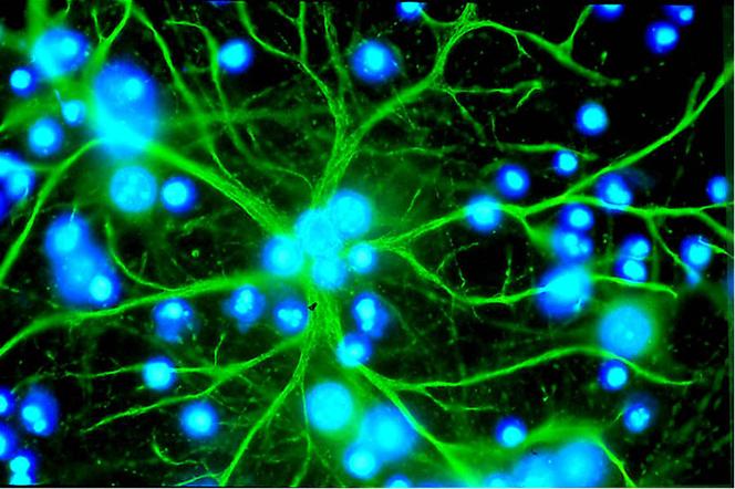 Astrocytes en culture émettant de nombreux prolongements étoilés (en vert). La couleur bleue représente les noyaux des autres cellules présentes dans la culture.