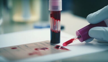 ce groupe sanguin serait "le maillon faible" du système immunitaire