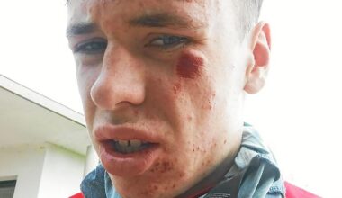 Le champion de France cadets Enzo Conan accidenté à l’entraînement