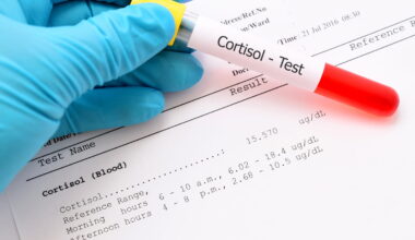 Cette boisson réduit le stress, c'est bon pour la santé "à long terme"