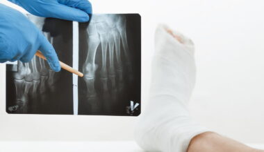 ils sont mauvais pour les os