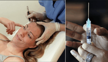 Saint-Denis : une médecin généraliste et une infirmière condamnées pour injections illégales de Botox