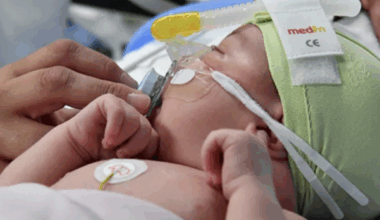 Gastro-entérite : 3 nourrissons décédés à La Réunion, des investigations en cours - LINFO.re