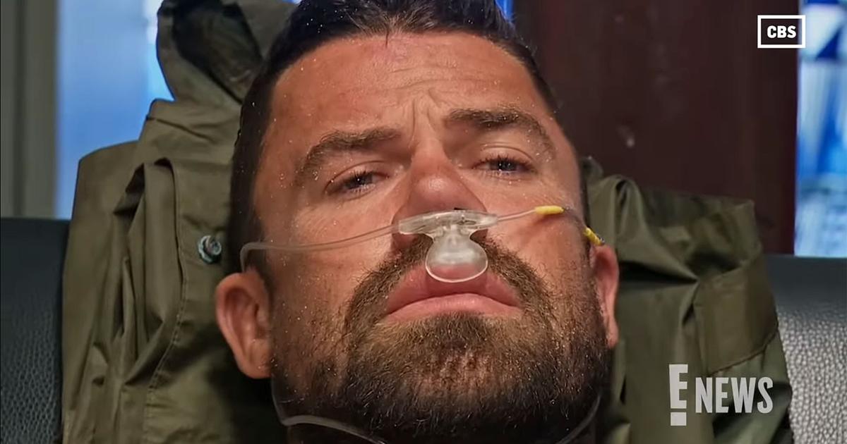 un candidat de «Survivor» mordu par un serpent venimeux