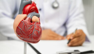 tout savoir sur la première cause d’AVC ischémiques