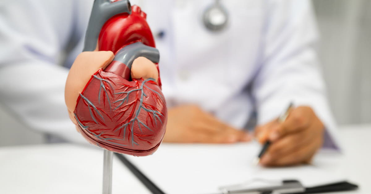 tout savoir sur la première cause d’AVC ischémiques