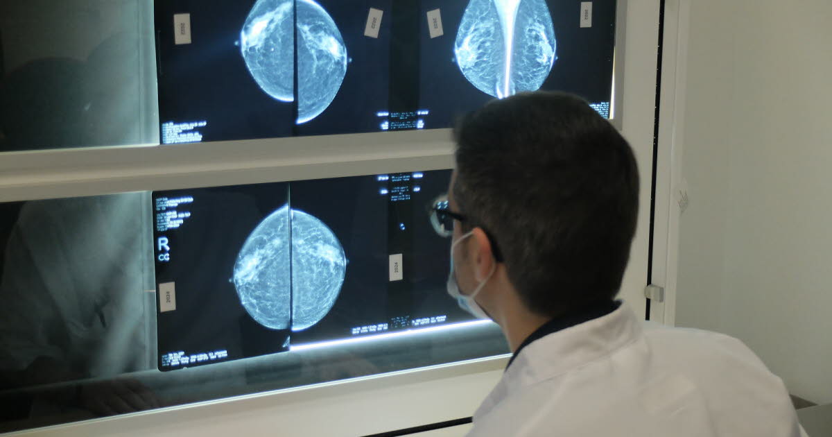 le dépistage du cancer du sein en net recul dans le Rhône