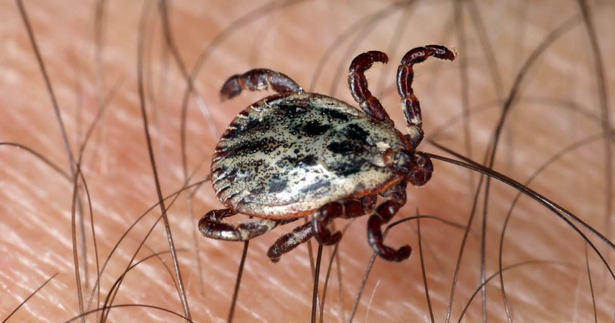 il consulte, mais c'est l'IA qui lui détecte la maladie de Lyme