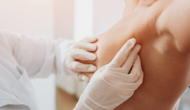 une étude confirme la hausse des cas chez les femmes jeunes