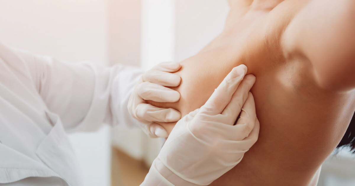 une étude confirme la hausse des cas chez les femmes jeunes