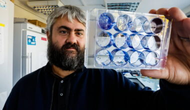 Marseille. Un anti-infectieux intestinal pour lutter contre le cancer du sein découvert par le CRCM