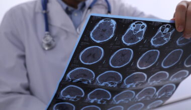 Je suis neurologue et voici le premier signe d'un déclin cognitif anormal, rien à voir avec la mémoire