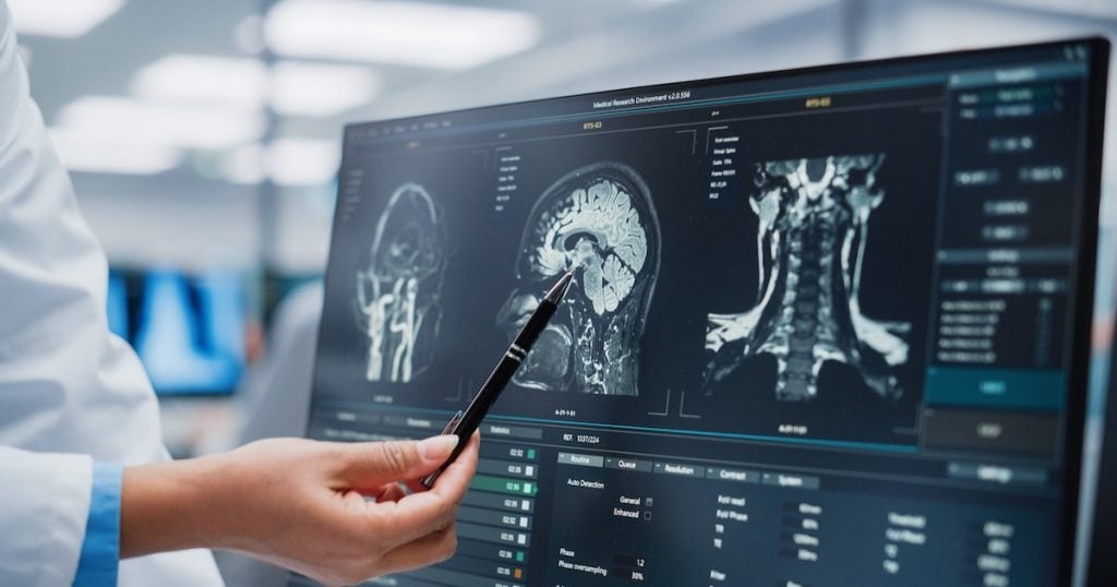 Une maladie cérébrale