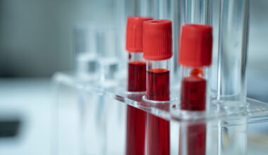 Plus fort que les autres, ce groupe sanguin serait un bouclier contre les maladies