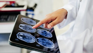 Page d'accueil Yahoo news