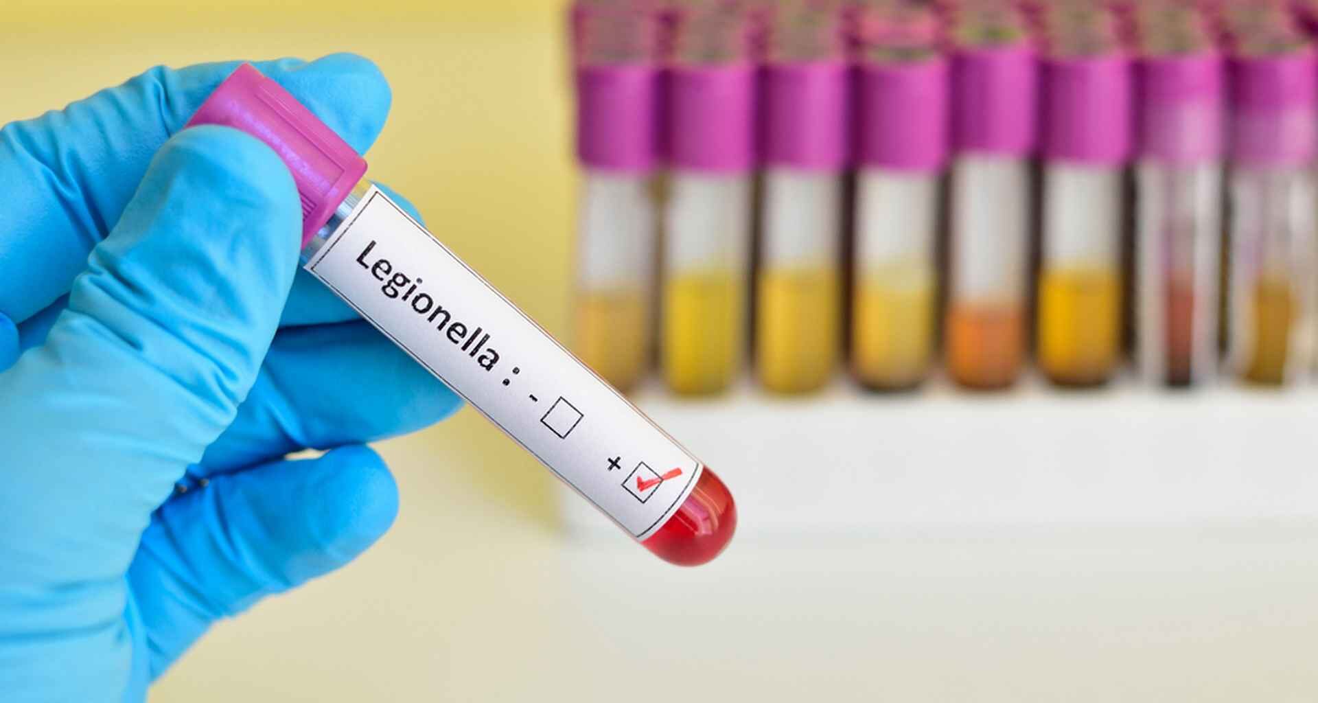 5 choses à savoir sur cette infection