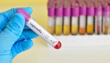 5 choses à savoir sur cette infection