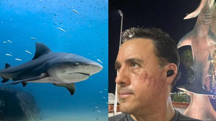Mauricio Hoyos, un biologiste mexicain, a été mordu  au visage fin septembre 2025 par un requin des Galapagos.