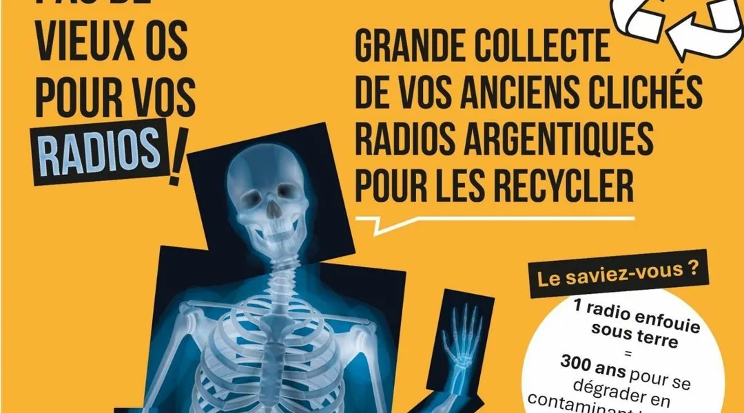 Recycler nos vieilles radios médicales : 11 points de collecte temporaires en Pays de la Loire