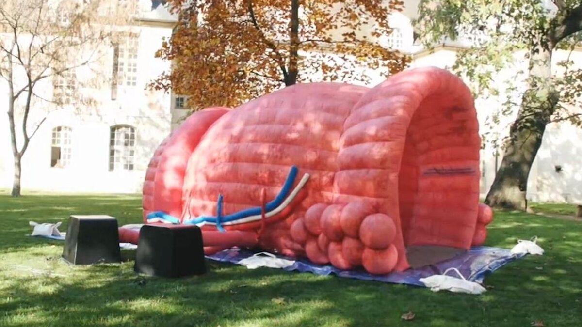 Pourquoi une prostate géante à Paris et à Emerainville ?