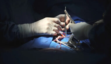 Page d'accueil Yahoo news