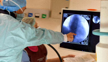 Seine-Maritime. Pourquoi les radiologues sont en grève ce lundi (et ce que ça implique pour vous)