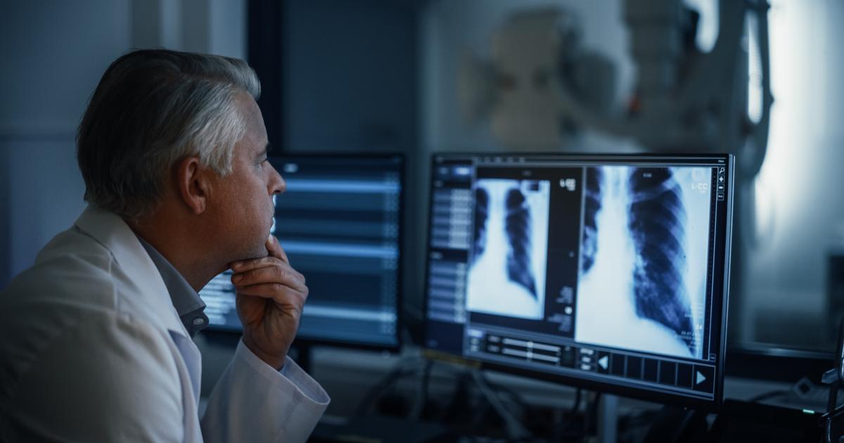 Avec l’IA, la révolution annoncée du dépistage du cancer du poumon