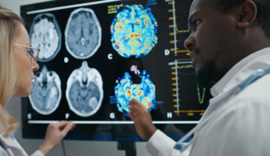 Ils veulent ralentir le vieillissement cérébral : ces nutriments changent tout