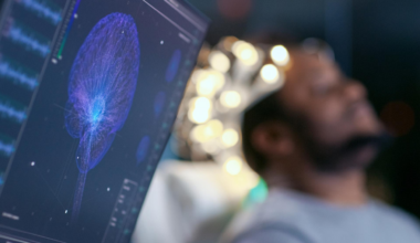 Cette invasion silencieuse du cerveau dépasse les pires scénarios des chercheurs