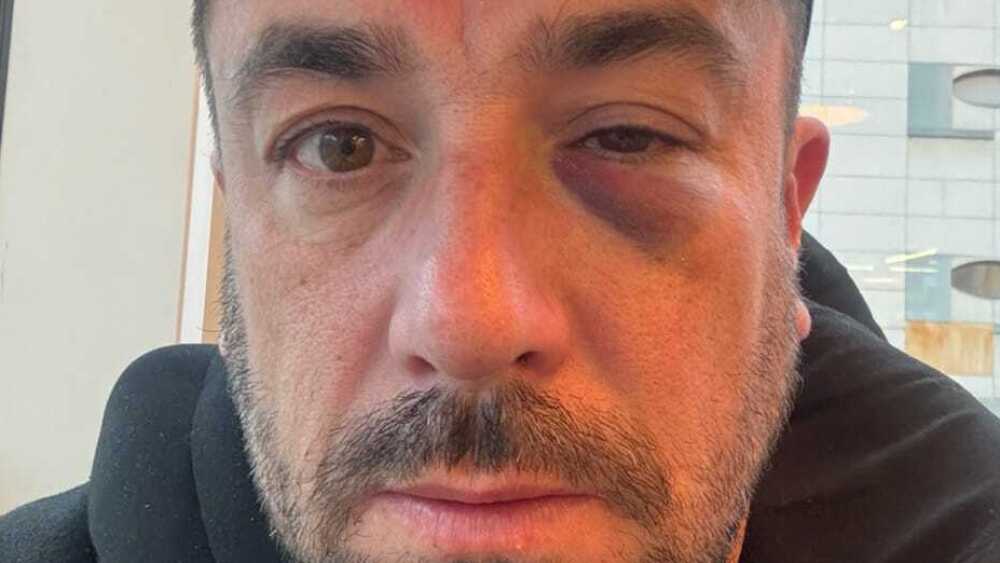 l’humoriste arlésien Anthony Joubert violemment agressé dans un train